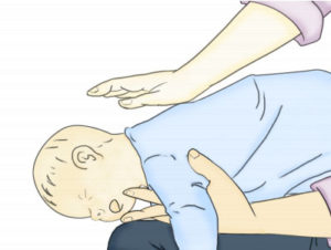 O que fazer quando o bebê engasgar?