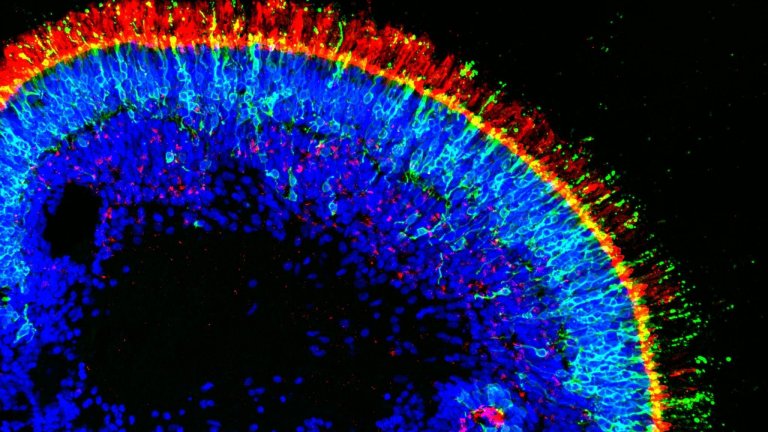 Cientistas criam retinas humanas funcionais em laboratrio
