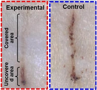 Pequenos geradores eltricos podem acelerar a cicatrizao de feridas