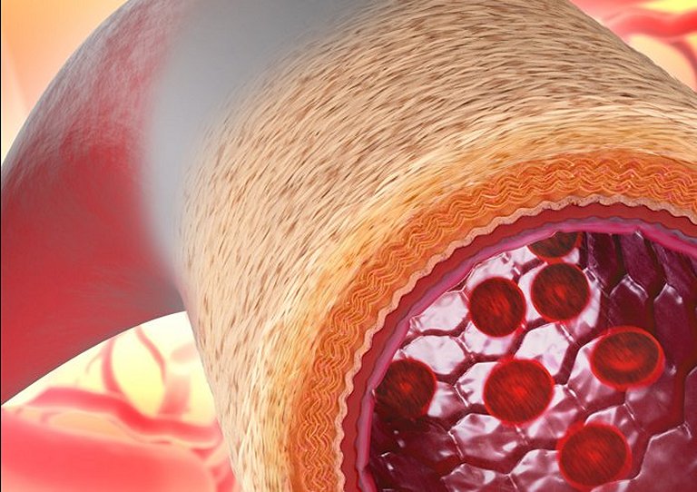 Cientistas fabricam vasos sanguneos 