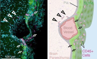 Descoberta nova estrutura de proteo do crebro