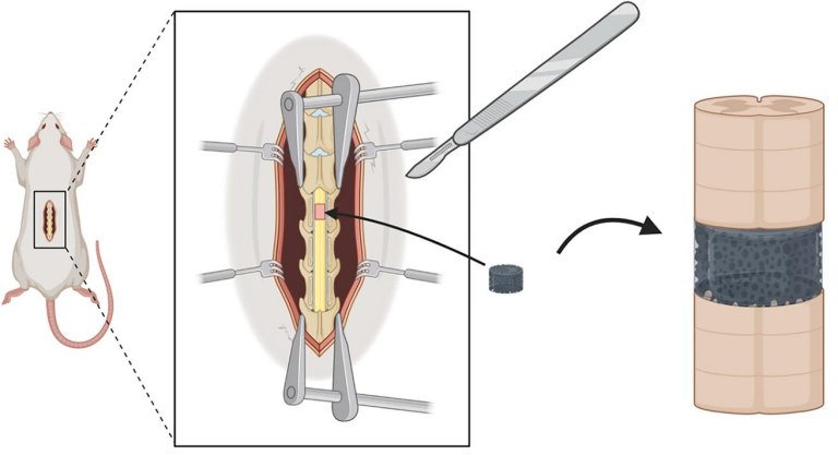Reparo de leses na medula espinhal ganha nova esperana com nanopartculas