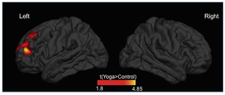 Praticantes de ioga tm crtex cerebral mais espesso