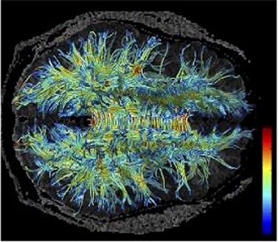 Revoluo na neurocincia: Neurnios do crebro no morrem com a idade