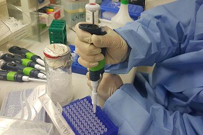 Fiocruz desenvolve exame rpido para diagnosticar zika