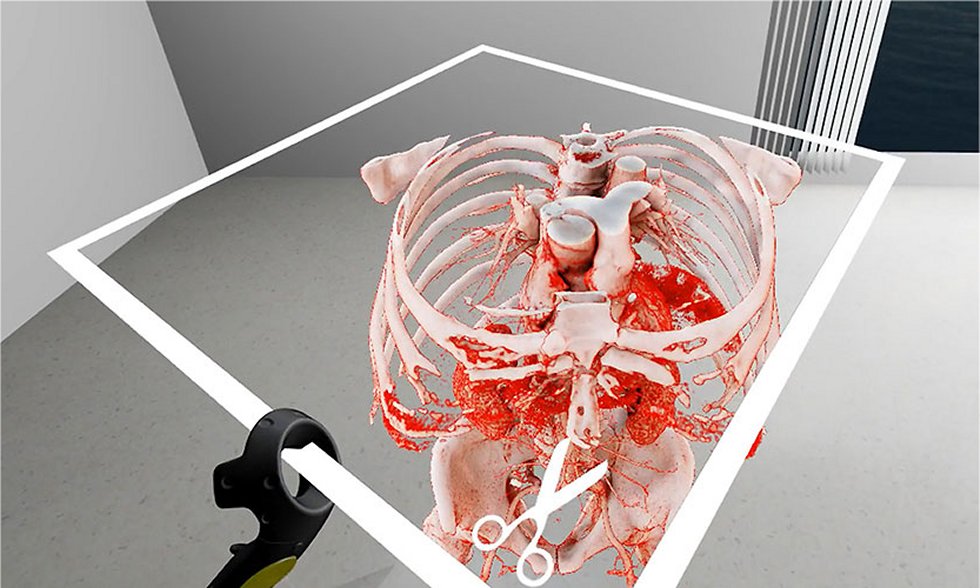Realidade Virtual forma melhores cirurgies