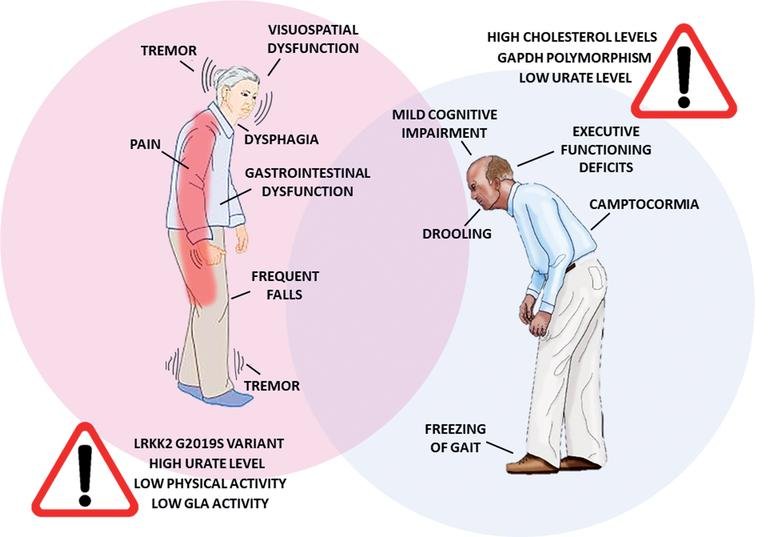 Como e por qu a doena de Parkinson atinge homens e mulheres de forma diferente?