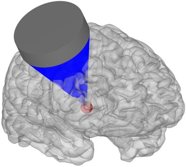 Ultra-som aplicado ao crebro muda comportamento e pode tratar depresso