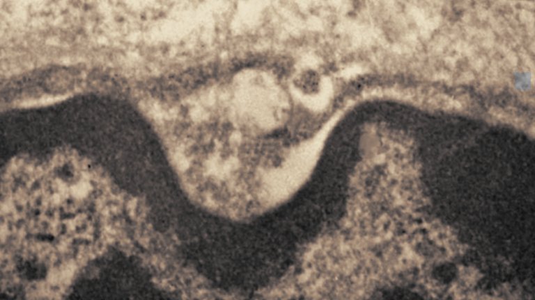 Novo coronavrus infecta e se multiplica nas glndulas salivares