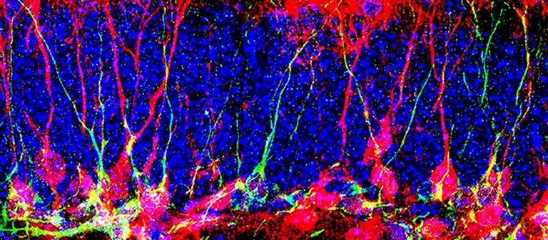 Cientistas descobrem como gerar novos neurnios no crebro