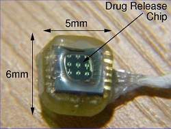Micro-implante libera medicamentos no organismo durante um ano
