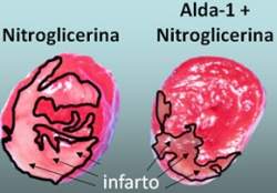Nitroglicerina é aliada do coração contra infartos