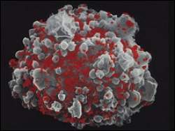 Cientistas provocam autodestruio de clulas infectadas pelo HIV