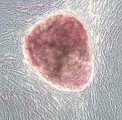 Clulas do lquido amnitico podem substituir clulas-tronco embrionrias