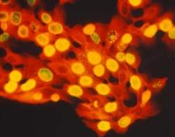 Clulas-tronco epiteliais comeam a revelar seus segredos