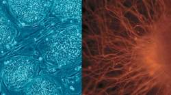 Nanopartículas magnéticas ajudam a entender funcionamento das células-tronco