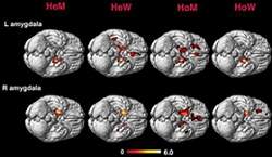 Estudo relaciona sexualidade e simetria dos hemisfrios cerebrais