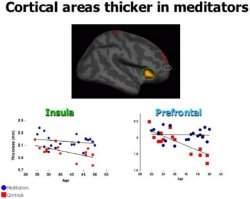 Meditação altera estrutura do cérebro em oito semanas