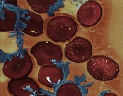 Coagulao do sangue  ligada e desligada com nanopartculas e laser
