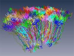 Conectoma: crebro humano comea a ser mapeado manualmente