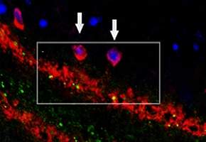 Desacoplar neurnios pode proteger contra Alzheimer e Parkinson