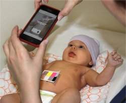 Aplicativo para celular detecta ictercia em bebs