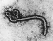 Criada vacina contra o vrus ebola