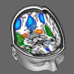 Banco de imagens do crebro  disponibilizado na internet