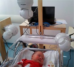 Computador identifica expresses de dor em recm-nascidos