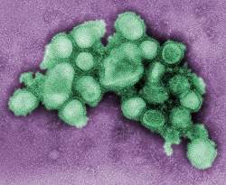 FAQ da gripe suna - Tire suas dvidas sobre a Influenza A H1N1
