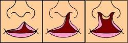 Fissura de palato poder ser revertida antes do nascimento