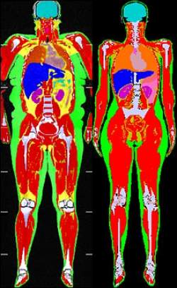 Aparelho permite enxergar gordura dentro do corpo