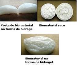 Brasileiras criam hidrogel de biomateriais para implantes sseos