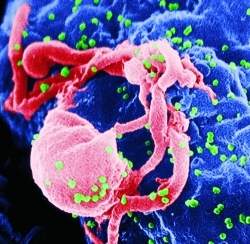 Imunidade natural contra HIV comea a ser compreendida
