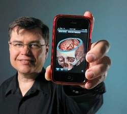 Aplicativo para iPhone permite diagnstico de derrame cerebral