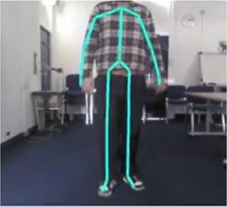 Kinect vira controlador de movimentos para Parkinson