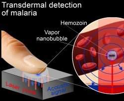 Nanotecnologia usar laser para detectar malria pela pele