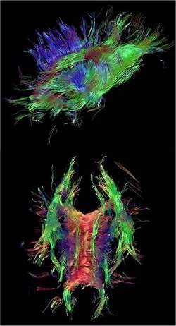 Mapas tridimensionais mostram conexes do crebro