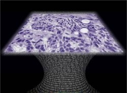 Microscpio sem lentes detecta cncer em nvel celular