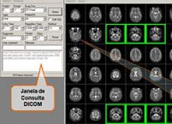 Computador supera especialistas na anlise de imagens mdicas