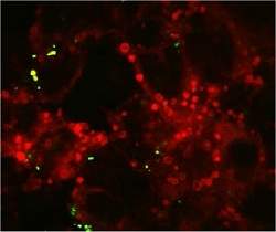 Nanopartículas e grafeno oferecem riscos à saúde