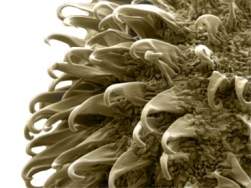 Nanopartculas encontram e tratam artrias endurecidas