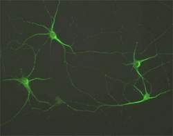 Estudos científicos sobre antidepressivos têm viés e até resultados invertidos