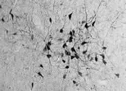 Descoberto um novo tipo de neurônio no cérebro
