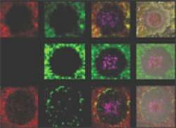 Papo de bactria: dicionrio bacteriano desvenda conversas intercelulares