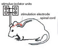 Mal de Parkinson  controlado com estmulos eltricos na medula