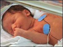 Cientistas descobrem como desenvolver pulmo de bebs prematuros