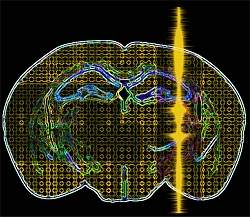 Crebro  estimulado de forma no-invasiva com ultrassom