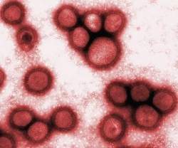 Cientistas reconstroem vrus da gripe espanhola de 1918