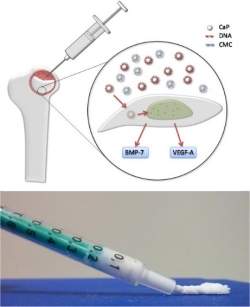 Blsamo para os ossos: nanopartculas com DNA
